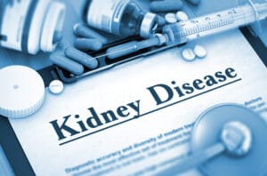 bigstock Kidney Disease Diagnosis Medi 121117388
